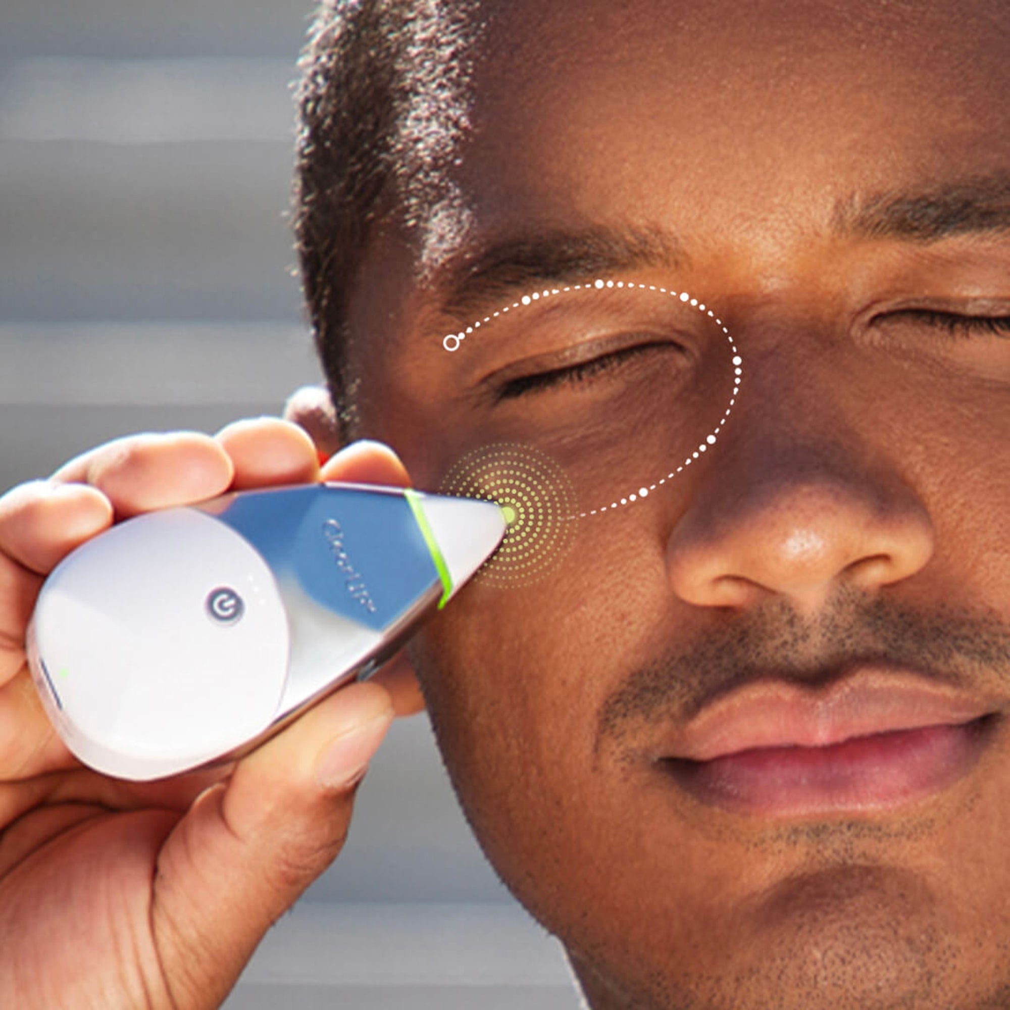 Tivic ClearUP 2.0 Bioelectronic Sinus Relief Device-Bioelectronic Sinus Relief Device Tivic ClearUP 2.0