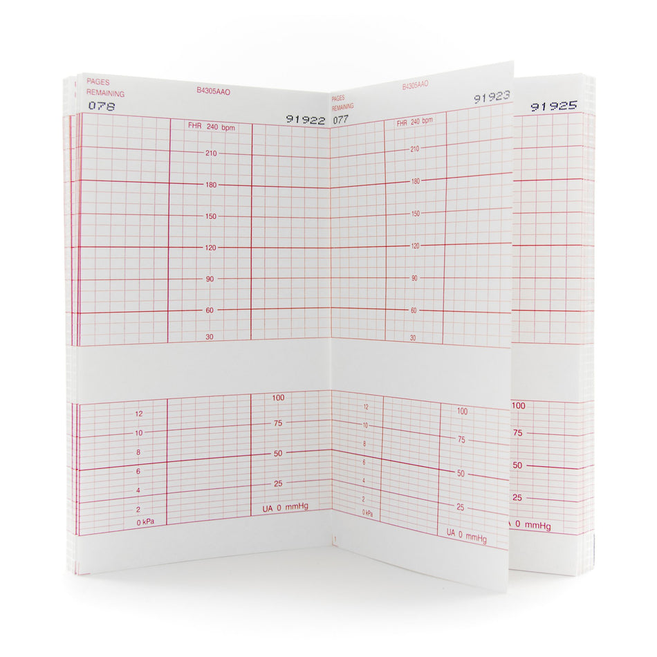 McKesson Fetal Monitoring Paper-Recording Chart Paper McKesson Z-Fold Red Grid