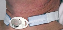 AirLife Tracheostomy Tube Holder-Tracheostomy Tube Holder AirLife 6.7 X 1 Inch Neonate / Pediatric