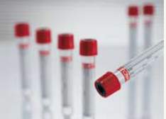 Vacuette Z Serum Clot Activator Venous Blood Collection Tube, 9 mL, 16 x 100 mm-VACUETTE Z Serum Clot Activator Venous Blood Collection Tube Clot Activator Additive 9 mL Pull Cap Polyethylene Terephthalate (PET) Tube