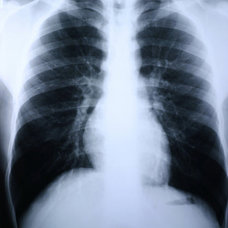 Clear Choice Performance X-Ray Film-X-Ray Film Clear Choice Performance 8 X 10 Inch Medium Speed Green Sensitive High