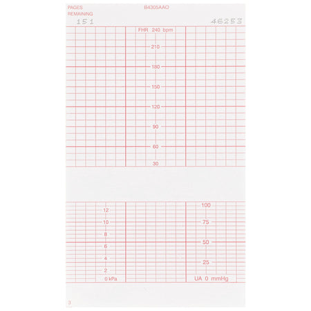 McKesson Fetal Monitoring Paper-Recording Chart Paper McKesson Z-Fold Red Grid