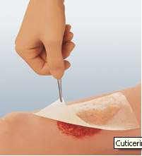 Cuticerin Oil Emulsion Impregnated Dressing, 3 x 8 Inch-Oil Emulsion Impregnated Dressing Cuticerin Rectangle 3 X 8 Inch Sterile