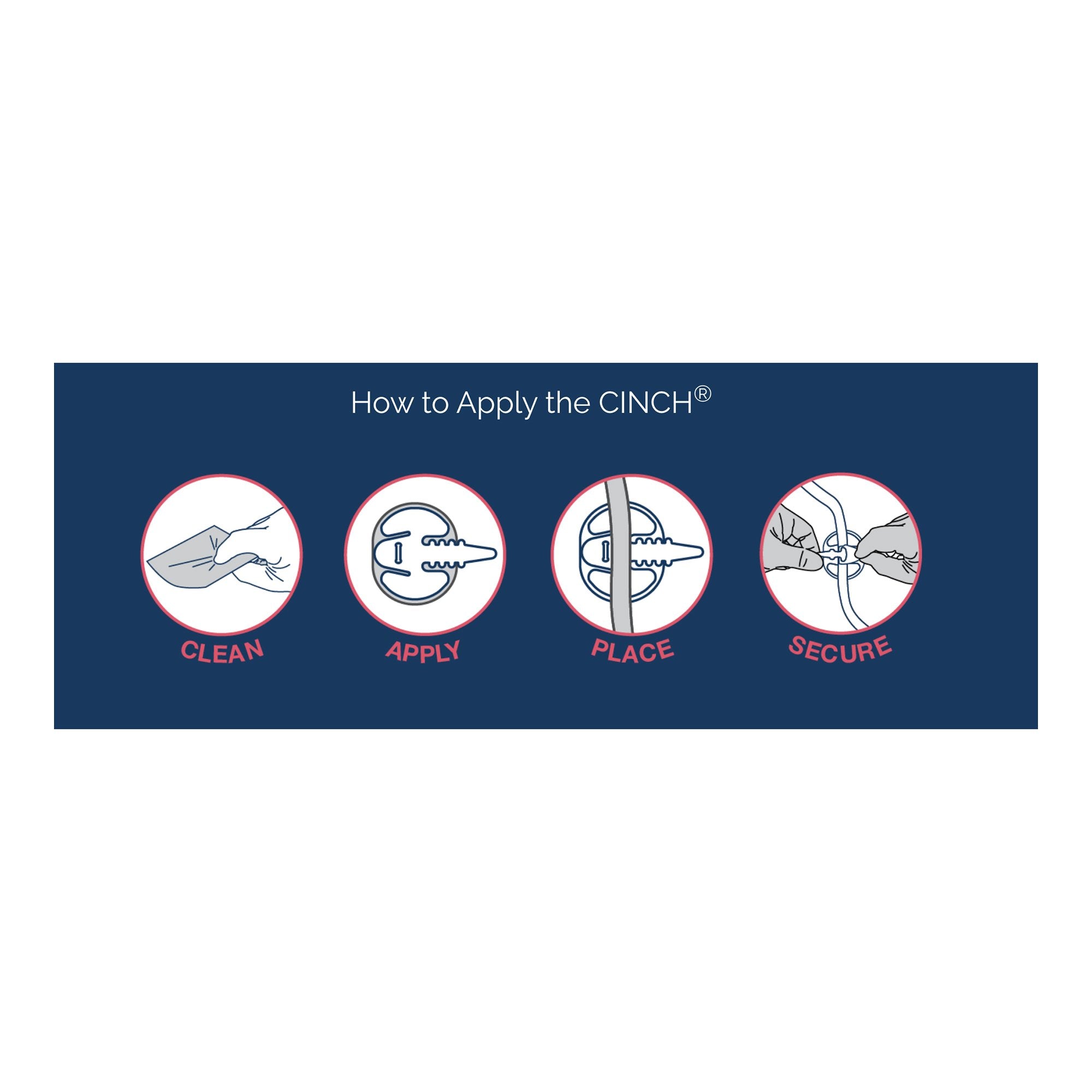 Cinch® Tube Securement Device, Medium - Nutritionals and Feeding Supplies>Nutritionals Accessories - Applied Medical Techn...