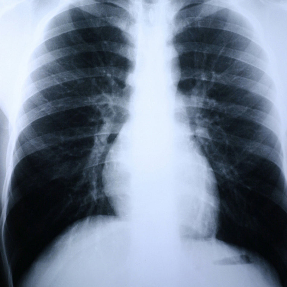 Clear Choice Performance X-Ray Film-X-Ray Film Clear Choice Performance 8 X 10 Inch High Speed Blue Sensitive High