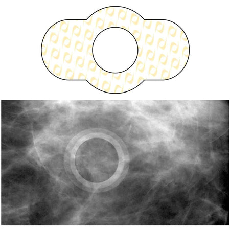 Spee-D-Ring Skin Marker-Radiology Skin Marker Spee-D-Ring