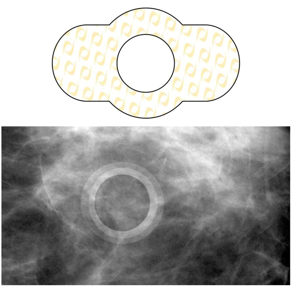 Spee-D-Ring Skin Marker-Radiology Skin Marker Spee-D-Ring