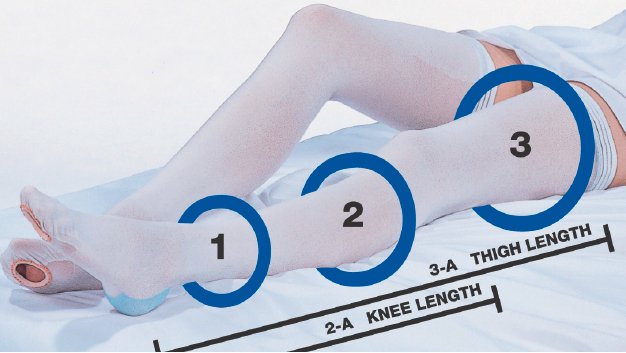 CAP Thigh High Anti-embolism Stockings, Extra Large / Short-Anti-embolism Stocking Cap Thigh High X-Large / Short White Inspection Toe