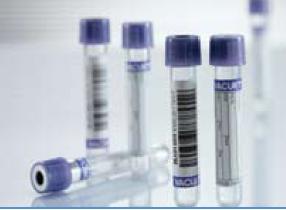 Vacuette Venous Blood Collection Tube, 13 x 75 mm, 4 mL, Lavender / Black Ring Closure-VACUETTE Venous Blood Collection Tube K2 EDTA Additive 4 mL Pull Cap Polyethylene Terephthalate (PET) Tube