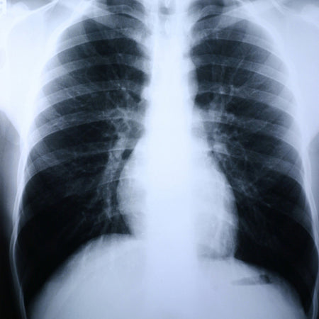 Clear Choice Performance X-Ray Film-X-Ray Film Clear Choice Performance 10 X 12 Inch Medium Speed Green Sensitive High