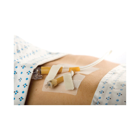 Cath-Secure Dual Tab Catheter Holder-Catheter Holder Cath-Secure Dual Tab 3 Inch Wrap Tabs x 3 Inch Wide Base