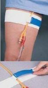 Cath-Mate II Leg Stap-"Leg Stap Cath-Mate II Stretches to fit Up to 26 Inch Thigh, Hook and Loop Closure"