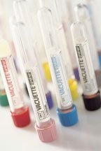 Vacuette Venous Blood Collection Tube, 6 mL, 13 x 100 mm-VACUETTE Venous Blood Collection Tube K2 EDTA Additive 6 mL Pull Cap Polyethylene Terephthalate (PET) Tube