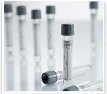 Vacuette Venous Blood Collection Tube, 6 mL, 13 x 100 mm-VACUETTE Venous Blood Collection Tube Sodium Fluoride / Potassium Oxalate Additive 6 mL Pull Cap Polyethylene Terephthalate (PET) Tube