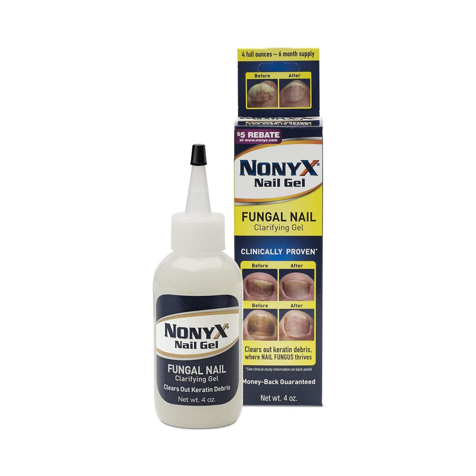 NonyX Ethanoic Acid Antifungal, 4 oz. Bottle-Antifungal NonyX Gel 4 oz. Bottle