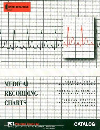Diagnostic ECG Recording Paper Philips Thermal Paper 50 mm X 100 Foot Roll Black Grid