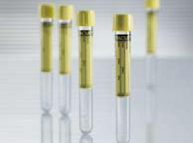 Vacuette Urinalysis Tube, 9 mL, 16 x 100 mm-VACUETTE Urinalysis Tube Plain 9.5 mL Pull Cap Polyethylene Terephthalate (PET) Tube