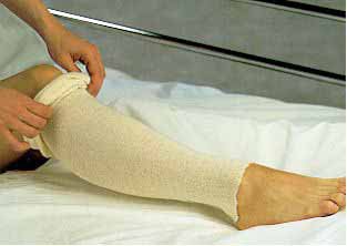 AlbaHealth Natural Cotton Tubular Stockinette, 3 Inch x 25 Yard-Stockinette Tubular Albahealth 3 Inch X 25 Yard Cotton NonSterile