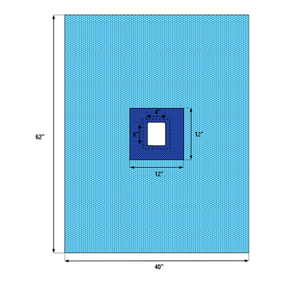 Welmed Sterile Fenestrated Drape, 40 x 62 Inch-Surgical Drape Fenestrated Drape 40 W X 62 L Inch Sterile