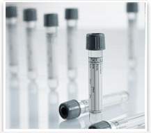 VACUETTE® Venous Blood Collection Tube Sodium Fluoride / Potassium Oxalate Additive 4 mL Pull Cap Polyethylene Terephthalate (PET) Tube