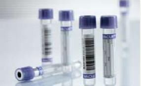 Vacuette Venous Blood Collection Tube, 4 mL, 13 x 75 mm, Lavender / Black Ring Closure-VACUETTE Venous Blood Collection Tube K3 EDTA Additive 4 mL Pull Cap Polyethylene Terephthalate (PET) Tube
