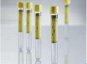 Vacuette Urinalysis Tube, 6 mL, 13 x 100 mm-VACUETTE Urinalysis Tube Plain 6.5 mL Screw Cap Polyethylene Terephthalate (PET) Tube
