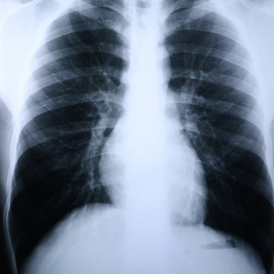 Clear Choice Performance X-Ray Film-X-Ray Film Clear Choice Performance 14 X 17 Inch Medium Speed Green Sensitive High