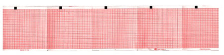 Recording Chart Paper Schiller™ Z-Fold Red Grid