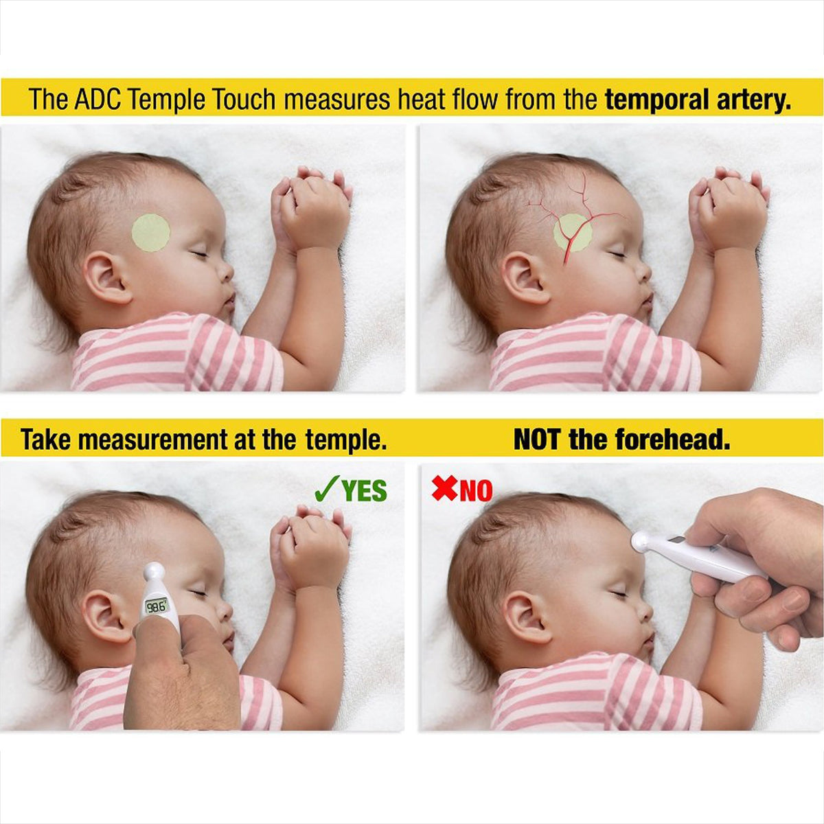 Temporal Contact Thermometer Adtemp™ Temporal Probe Handheld